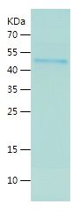 Recombinant Human IP6K1