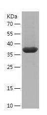 Recombinant Human MAGOH