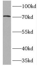TOP1MT antibody