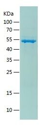 Recombinant Human PRKAR1A
