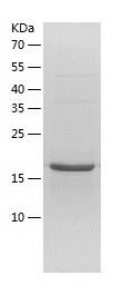 Recombinant Human NOP16
