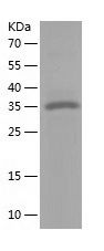 Recombinant Human TP53I3