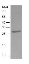 Recombinant Human NUBP2