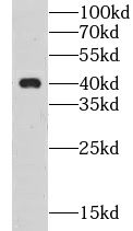 CLEC4G antibody