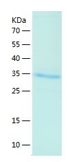 Recombinant Human KCTD10