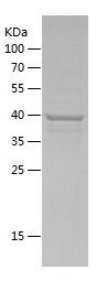 Recombinant Human TMEM168