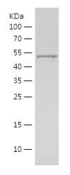 Recombinant Human MMP1