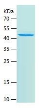 Recombinant Human B3GALT4