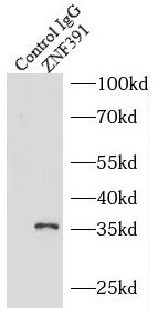 ZNF391 antibody