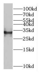 GEMIN8 antibody