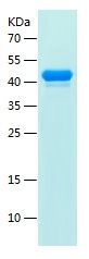 Recombinant Mouse TNNT2