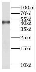 XXYLT1 antibody