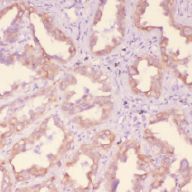 IHC_mouse lung cancer