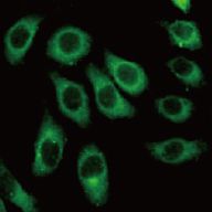 IF_Hela cell