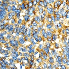 IHC_human hepatic tissue